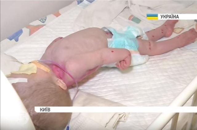 киев больница медицина сирота