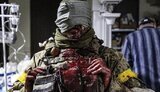 зсу,поранення