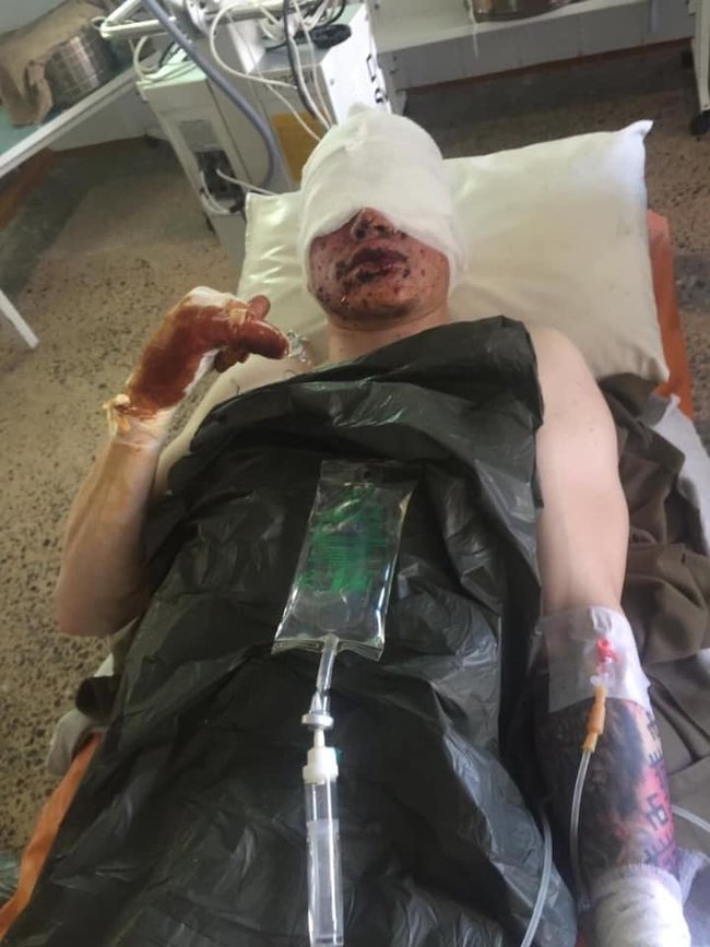 Раненым бойцам 74 ОРБ нужна помощь, - волонтер Дмитрова 02