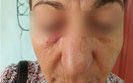 П'яна пасажирка побила кондукторку тролейбуса через прохання одягти маску. ФОТО