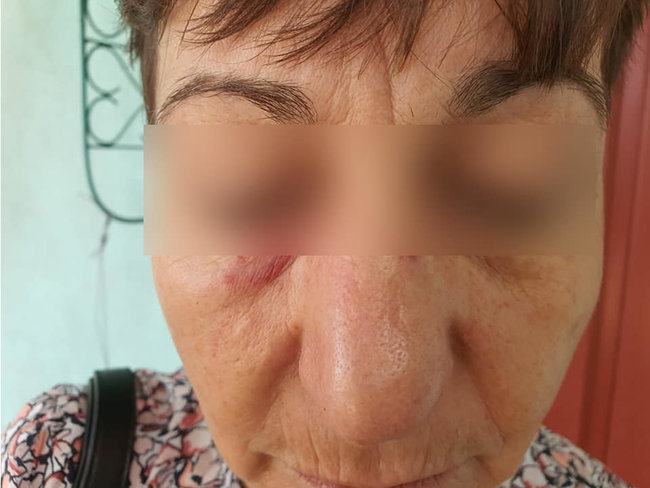Пяна пасажирка побила кондукторку тролейбуса через прохання одягти маску 01