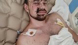 Раненому при выполнении боевой задачи на Донбассе комвзвода 54-го ОРБ Борису Бассу нужна помощь в лечении и реабилитации, - волонтер Самойлова. ФОТО