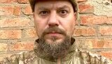 &#34;Ти чуєш цей запах? Так пахне біль&#34;. Один день із військовим медиком