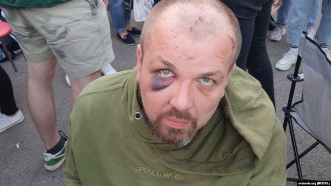 Зверства белорусского ОМОНа: жуткие кадры пыток задержанных 08