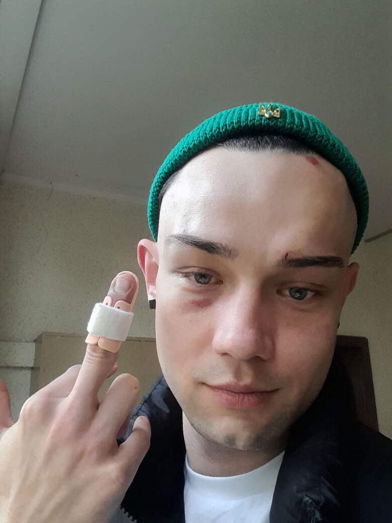 Любитель России избил украинца в Германии из-за Тризуба на шапке 02