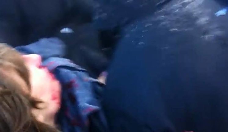 Вилкул и Удод отдали приказ милиции Днепропетровска разогнать Евромайдан. Десятки активистов ранены. ВИДЕО