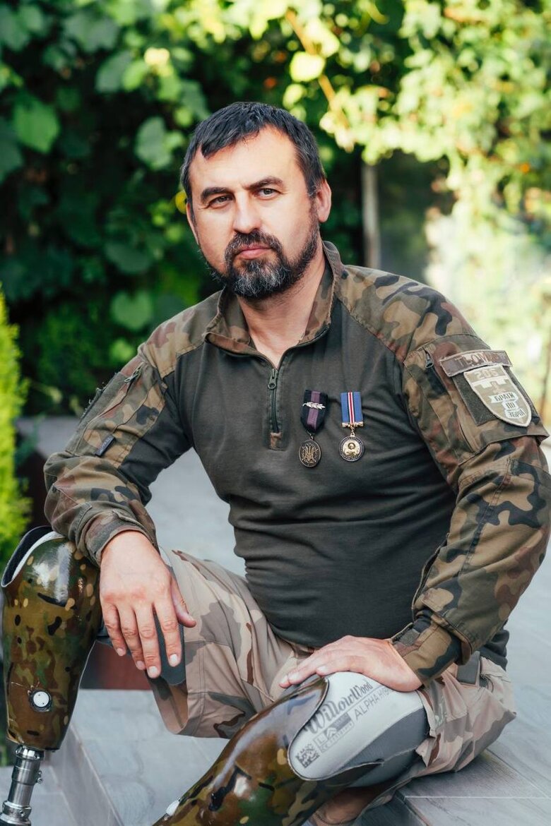 Військовослужбовець Артем Мороз: У мене влили два з половиною літри крові. Я не знаю, як я вижив 07 Військовослужбовець Артем Мороз: У мене влили два з половиною літри крові. Я не знаю, як я вижив 07