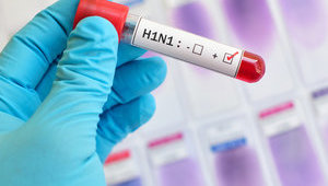 В Україні зафіксували 2 нові випадки свинячого грипу