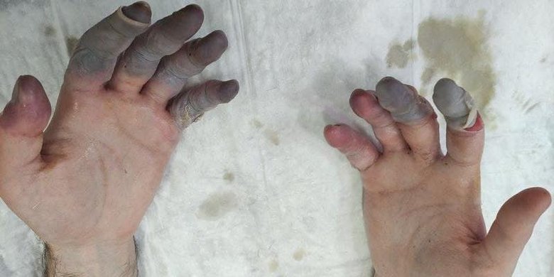 Терміновий збір для захисників на передову: подробиці