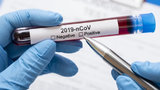 Ukraine to launch mass production of Covid-19 tests, - Ministry of Health