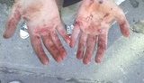 Two Drunk Hoodums Beat Up a Pregnant Woman with a Metal Chain