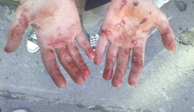 Two Drunk Hoodums Beat Up a Pregnant Woman with a Metal Chain