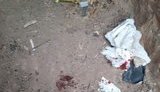 Стан пораненого вчора воїна стабільний. За цим фактом направлено ноту в ОБСЄ, - українська делегація у ТКГ