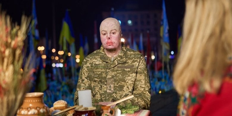 Yegor Babenko, a veteran of the Armed Forces of Ukraine, told his story after suffering serious injuries