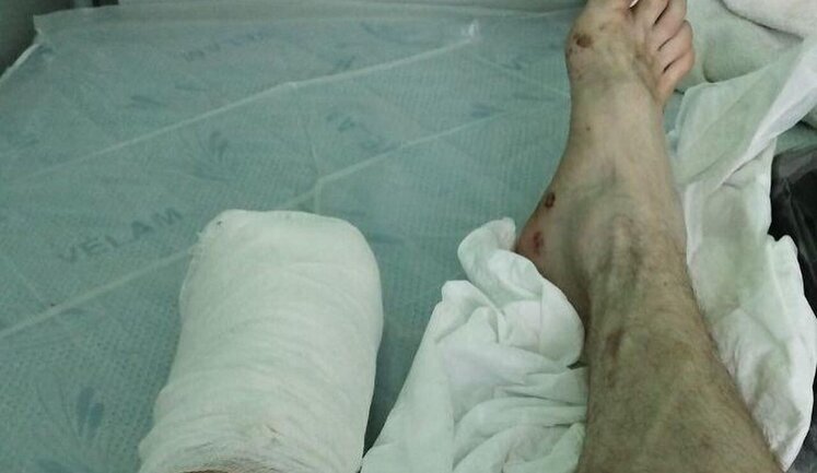 Українському воїну Сергію Дзюбановському, який втратив ногу на бойовому завданні, потрібна допомога у придбанні протезу. ФОТОрепортаж