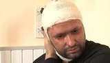 Чижмарь: Я не почувствовал, что кислота попала под капюшон и сильно промок воротник. ВИДЕО.