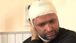 Чижмарь: Я не почувствовал, что кислота попала под капюшон и сильно промок воротник. ВИДЕО.