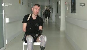 Військовий Микола Шот із чотирма ампутаціями проходить реабілітацію у Львові: "Хочу піти у спорт. Буду бігом займатися. Мрію стати паралімпійцем". ВIДЕО