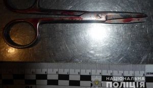 Чоловік встромив ножиці в шию товариша на столичному Гідропарку, потерпілого доставили в лікарню, - Нацполіція. ФОТО