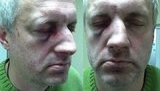 харьков нападение жертва титушки