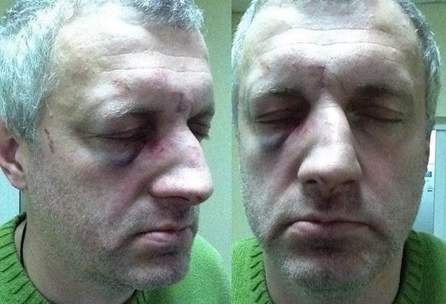 харьков нападение титушки жертва