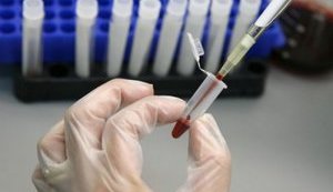 Около миллиона украинцев не знают об имеющемся у них гепатите C, - Ляшко. ВИДЕО