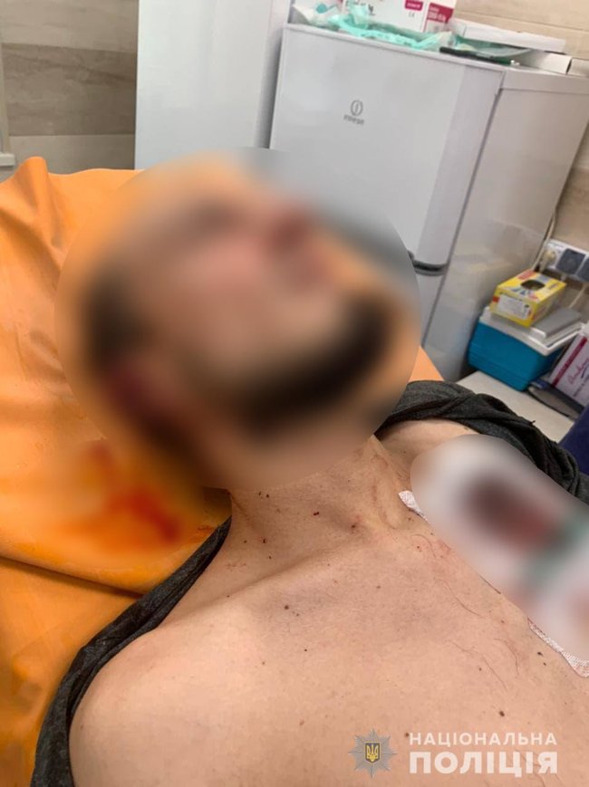 Конфлікт між чоловіками на Черкащині закінчився стріляниною - двох людей госпіталізували, - Нацполіція 01