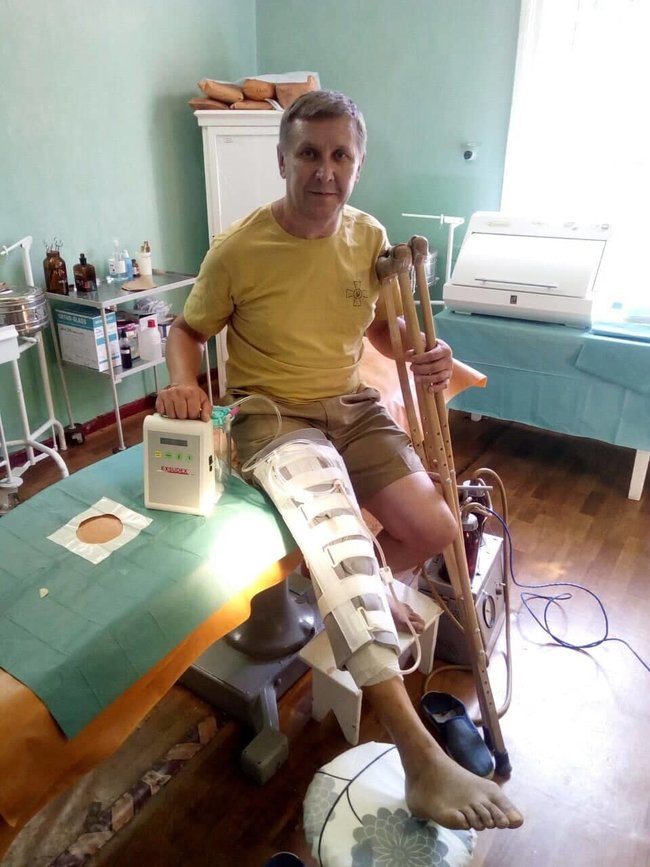 Завдяки допомозі громадян у Житомирський військовий госпіталь купили два апарати для вакуумної терапії ран, - волонтерка Юсупова 03
