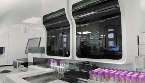 Предсказать, будет ли COVID-19 у больного в тяжелой форме или нет, можно по общему анализу крови, - нидерландские ученые