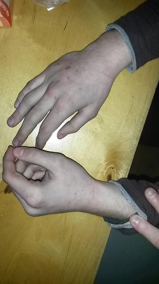 милиция побои