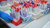Health Ministry: Antibody tests may begin next week