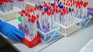 Тестирование на антитела к COVID-19 могут начать уже на следующей неделе, - Степанов