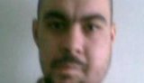 Пытки в милиции или, как выбивают признания: сломанная челюсть и 2 года в ожидании операции. ВИДЕО.