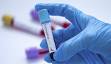 WHO specialist to arrive in Ukraine amid first registered case of Covid-2019