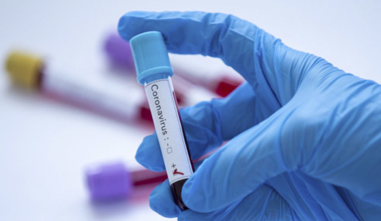 WHO specialist to arrive in Ukraine amid first registered case of Covid-2019