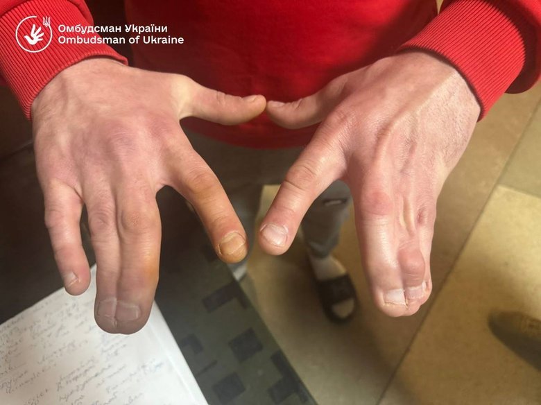 тцк порушення