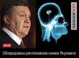 Рентгеновский снимок