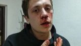 Невідомі в балаклавах побили активістів у Дніпрі, є травми черепа, щелепи та носа. ФОТОрепортаж