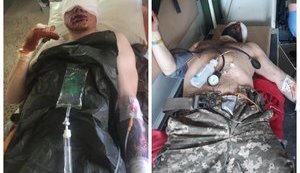 Раненым бойцам 74 ОРБ нужна помощь, - волонтер Дмитрова