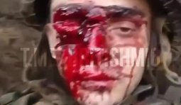 Рашист скиглить, що залишився без ока внаслідок невдалого штурму підрозділу