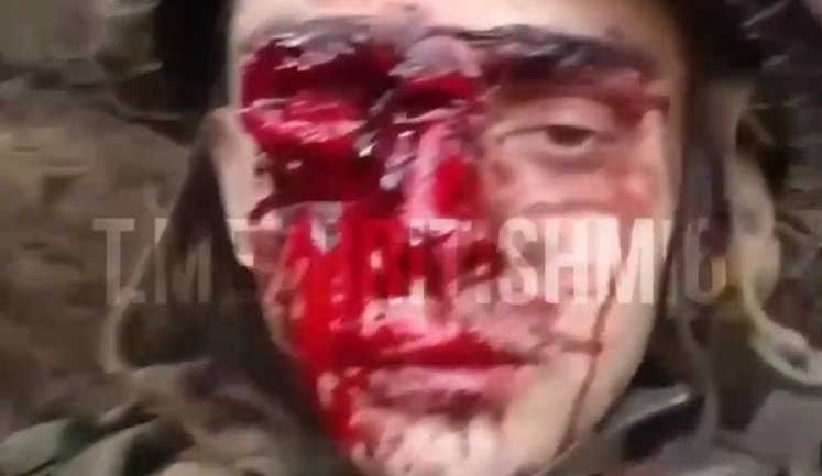 "Теперь я пират одноглазый. Я в аху#", - скиглить рашист після невдалого штурму. ВIДЕО 18+