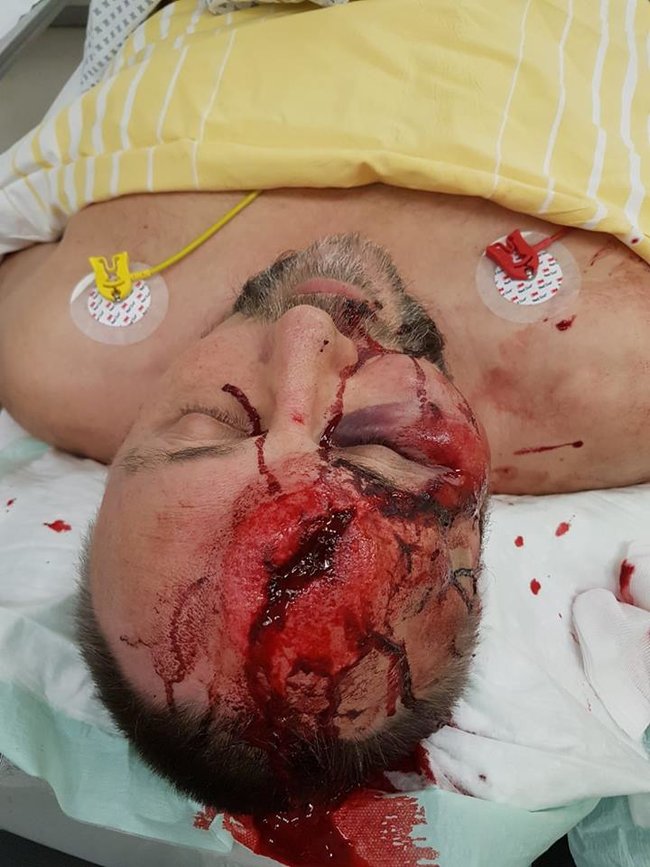 Депутата Бундестага Магница из партии друзей Путина до полусмерти избили в Бремене 02