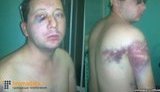 ВРП відмовилася звільнити суддю Маліновську, яка заарештувала побитого "беркутівцями" під час Євромайдану фотографа Нужненка, - адвокат Маселко. ФОТО