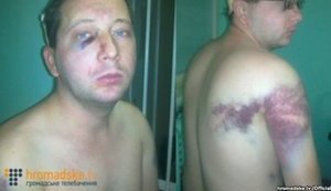 ВСП отказался уволить судью Малиновскую, арестовавшую избитого "беркутовцами" во время Евромайдана фотографа Нужненко, - адвокат Маселко. ФОТО