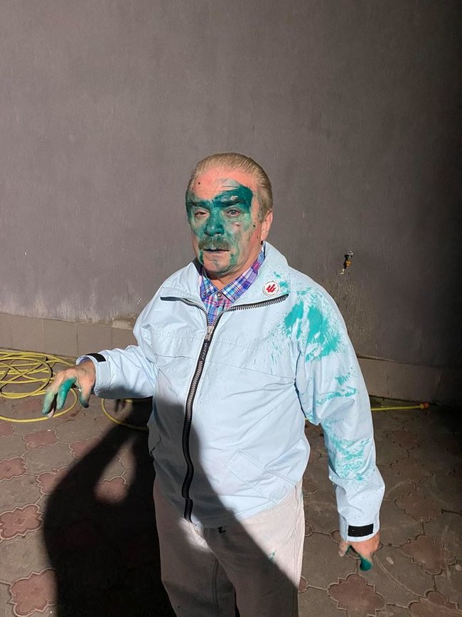 У Тернополі облили зеленкою кандидата на посаду мера від партії Ляшка Барну 02
