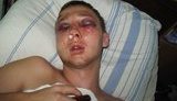 Милиционер зверски избил рок-музыканта в Николаеве: "Он бил, лежавшего без сознания, ногами по голове". ФОТО