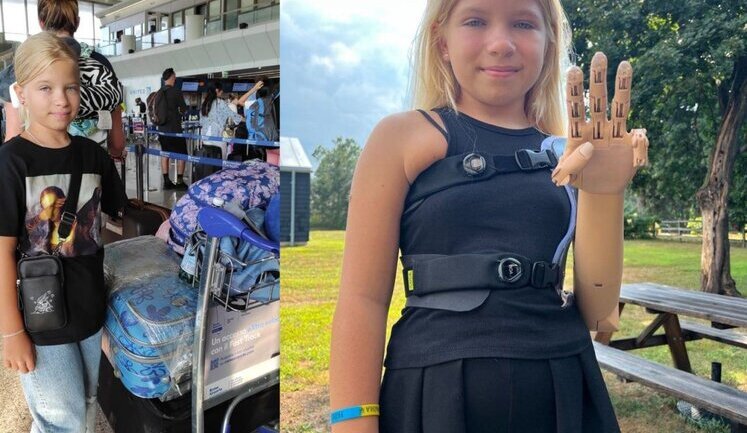 9-year-old Sasha from Bucha shows trident with prosthetic hand. PHOTO