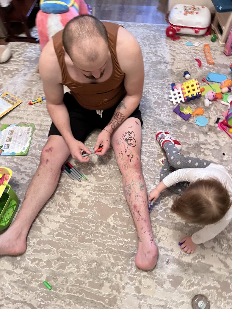 Микола Русецький, позивний Молот: Хочу власним прикладом показувати, що без руки чи ноги все одно можна жити і працювати на захист України 07