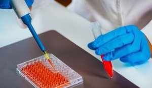 ІФА-тестування у Львові виявило 600 осіб з антитілами до COVID-19