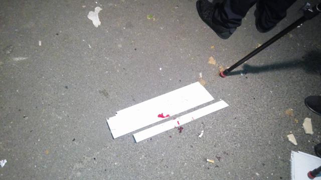 MP Mosiichuk wounded in explosion near Espreso TV last night 10